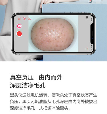 小米有品媄拾智能可視吸黑頭儀 告別黑頭，開(kāi)啟“眼見(jiàn)為實(shí)”的清潔新時(shí)代